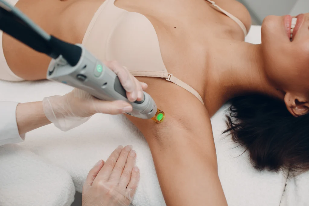 Laser hair removal session targeting underarm area