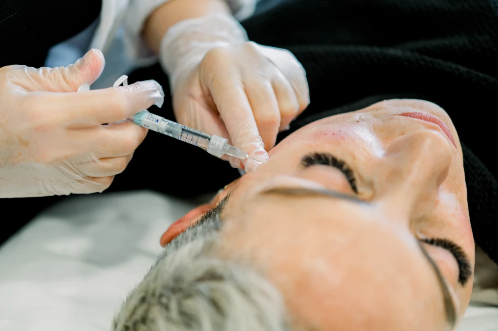 Aesthetic procedure applying dermal fillers to a client's face.