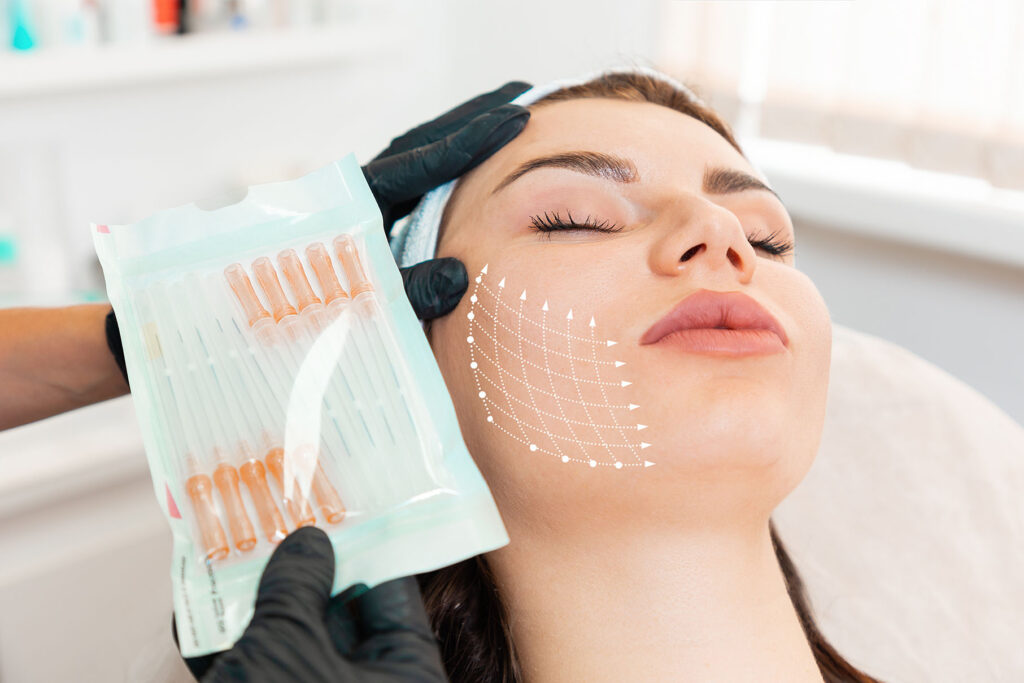 practitioner wearing black gloves holds a package of thread needles near a person’s cheek marked with dotted guide lines