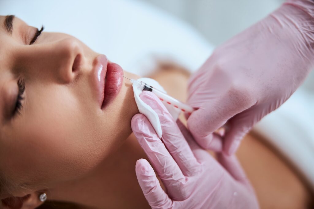 Close-up of a person lying down while a gloved practitioner uses a syringe near the upper lip.