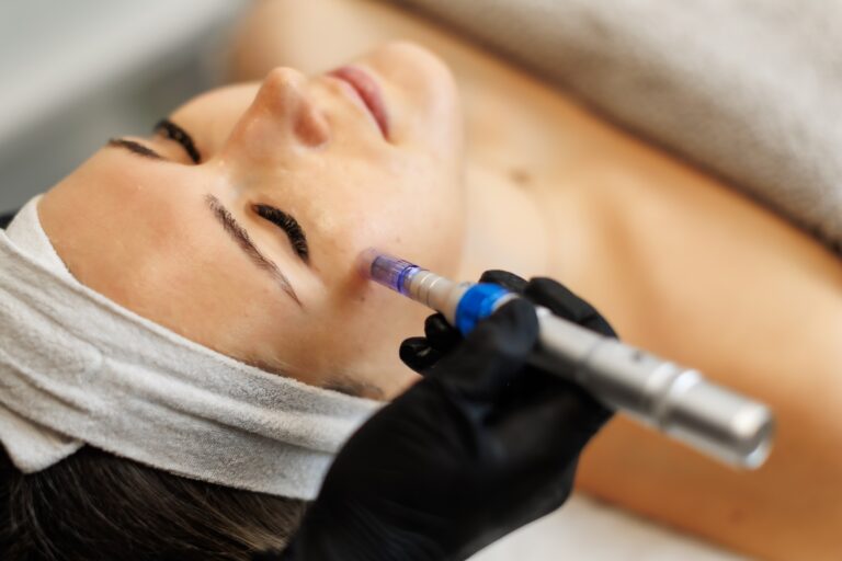Gloved hand holding a microneedling pen against a woman’s cheek as she lies on a treatment bed.