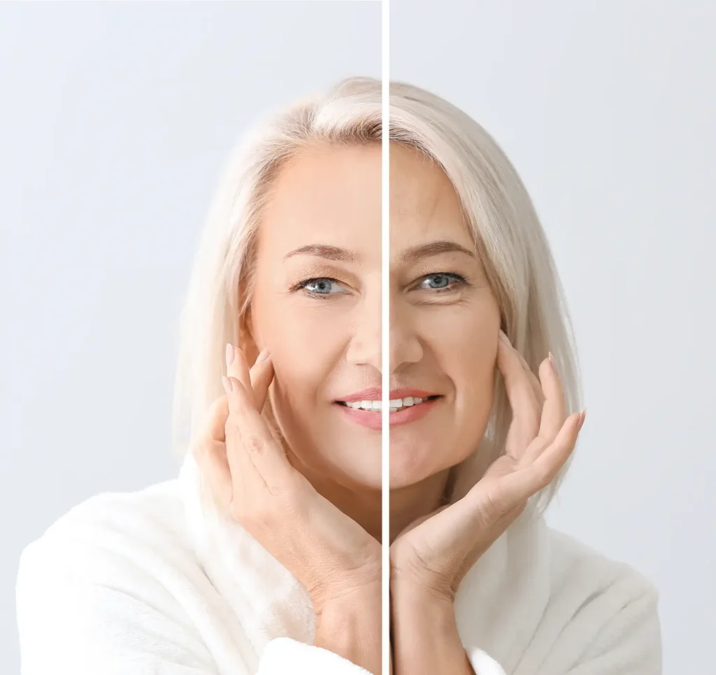 before and after comparison showing improved facial symmetry and smoother skin