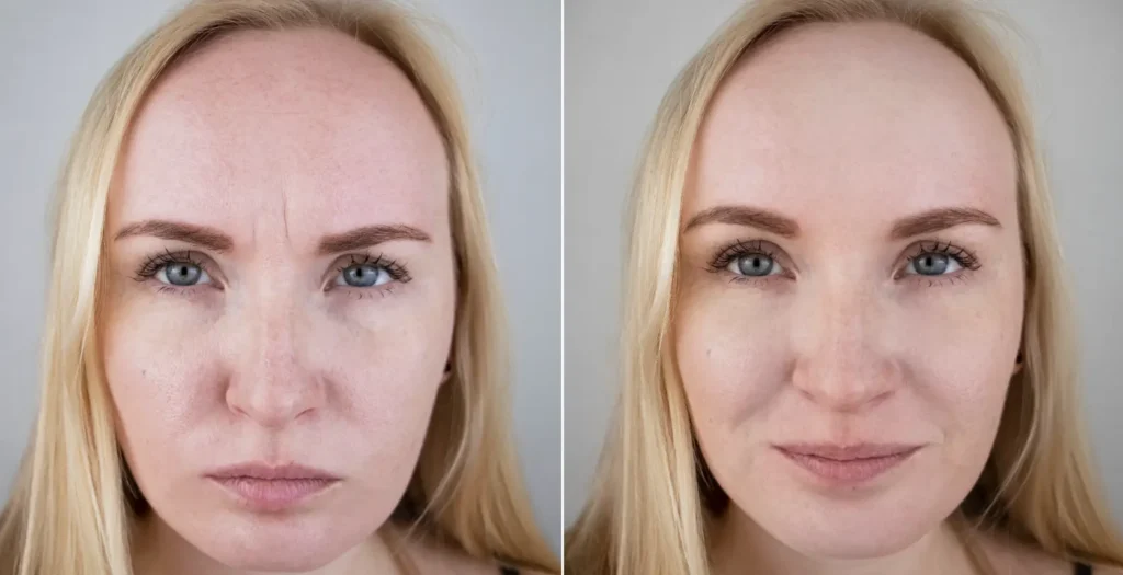Side-by-side facial portraits showing visible differences in skin tone and forehead lines