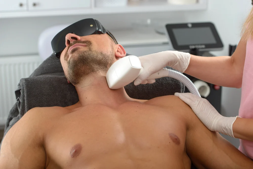 Provider performs laser hair removal on a man's neck while he wears protective eye shields.